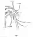 Fig. 06 - Method of treating disease by auricular anesthesia of cranial nerves