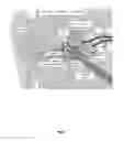 Fig. 08 - Method of treating disease by auricular anesthesia of cranial nerves