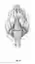 Fig. 18 - Method of treating disease by auricular anesthesia of cranial nerves