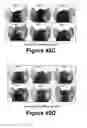 Fig. 38 - Molecular and Herbal Combinations with Methotrexate for Treating Diseases and Inflammatory Ailments