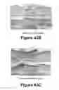 Fig. 42 - Molecular and Herbal Combinations with Methotrexate for Treating Diseases and Inflammatory Ailments