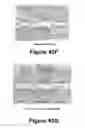 Fig. 44 - Molecular and Herbal Combinations with Methotrexate for Treating Diseases and Inflammatory Ailments