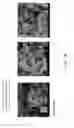 Fig. 03 - METHOD OF USING STEM CELLS AND NANOWHISKERS