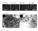 Fig. 12 - Multipotent postnatal stem cells from human periodontal ligament and uses thereof