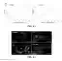 Fig. 10 - COMPOSITIONS AND METHODS FOR TREATMENT OF VESSEL DISEASE