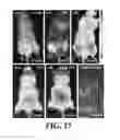 Fig. 12 - COMPOSITIONS AND METHODS FOR TREATMENT OF VESSEL DISEASE