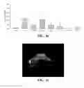 Fig. 14 - COMPOSITIONS AND METHODS FOR TREATMENT OF VESSEL DISEASE