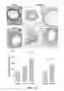 Fig. 15 - COMPOSITIONS AND METHODS FOR TREATMENT OF VESSEL DISEASE