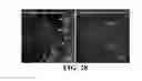 Fig. 19 - COMPOSITIONS AND METHODS FOR TREATMENT OF VESSEL DISEASE