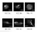 Fig. 11 - Methods of treating diseases with human trophoblast stem cells