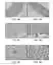 Fig. 13 - Methods of treating diseases with human trophoblast stem cells