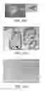Fig. 14 - Methods of treating diseases with human trophoblast stem cells