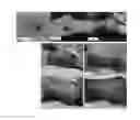 Fig. 03 - for the treatment of solid tumors in humans