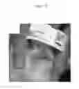 Fig. 17 - for the treatment of solid tumors in humans