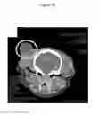 Fig. 18 - for the treatment of solid tumors in humans