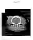 Fig. 19 - for the treatment of solid tumors in humans