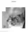 Fig. 21 - for the treatment of solid tumors in humans
