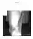 Fig. 23 - for the treatment of solid tumors in humans