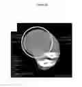Fig. 24 - for the treatment of solid tumors in humans