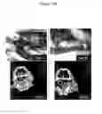 Fig. 27 - for the treatment of solid tumors in humans