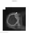 Fig. 36 - for the treatment of solid tumors in humans