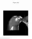 Fig. 42 - for the treatment of solid tumors in humans