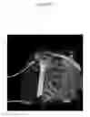 Fig. 43 - for the treatment of solid tumors in humans