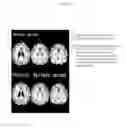 Fig. 07 - Composition for brain activation, comprising ginseng fruit extract