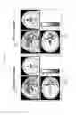 Fig. 08 - Composition for brain activation, comprising ginseng fruit extract