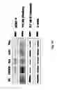 Fig. 24 - Composition comprising a purified extract isolated from var. containing abundant amount of active ingredient or the compounds isolated therefrom, as an active ingredient for treating a chronic obstructive pulmonary disease and the use thereof