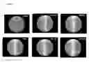 Fig. 22 - Anti-angiogenic peptides and uses thereof