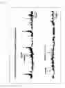 Fig. 02 - Postprandial gastrokinetic agent