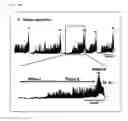 Fig. 06 - Postprandial gastrokinetic agent