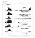Fig. 11 - Postprandial gastrokinetic agent