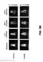 Fig. 18 - Blood substitute composition and method of use