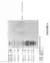 Fig. 07 - Botulinum Chimera Compositions for Axonal Regenerative Therapy During Spinal Cord Injury