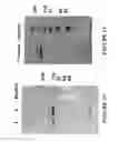 Fig. 11 - Botulinum Chimera Compositions for Axonal Regenerative Therapy During Spinal Cord Injury