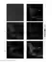 Fig. 17 - Botulinum Chimera Compositions for Axonal Regenerative Therapy During Spinal Cord Injury