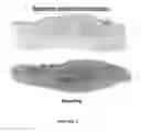 Fig. 05 - Methods for treating pain by topical application and transdermal delivery of botulinum toxin