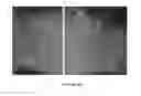 Fig. 08 - Methods for treating pain by topical application and transdermal delivery of botulinum toxin