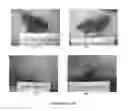 Fig. 12 - Methods for treating pain by topical application and transdermal delivery of botulinum toxin