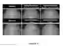 Fig. 22 - Methods for treating pain by topical application and transdermal delivery of botulinum toxin