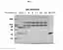 Fig. 04 - Compositions and methods for treatment of homocystinuria