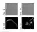 Fig. 17 - Bacillus based delivery system and methods of use