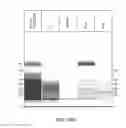 Fig. 33 - Process for purifying recombinant circumsporozoite protein
