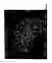 Fig. 05 - Co-processed carbohydrate system as a quick-dissolve matrix for solid dosage forms