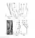 Fig. 09 - Gene therapy for neurodegenerative disorders