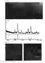 Fig. 06 - Metal Oxide Nanoparticle-Based Magnetic Resonance Imaging Contrast Agent with a Central Cavity