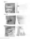 Fig. 10 - Bioabsorbable polymers