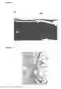 Fig. 12 - Bioabsorbable polymers